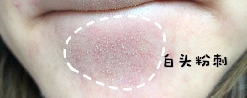 你知道什么是闭口吗,闭口和不是闭口