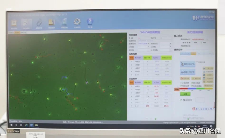 听说捐精可以“发家致富”？医生：是你想太多