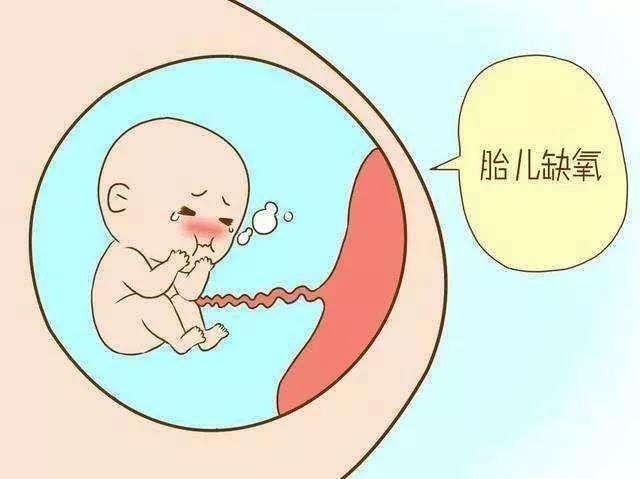 孕妇如何避免胎儿缺氧,脐带绕颈怎么可以避免胎儿缺氧