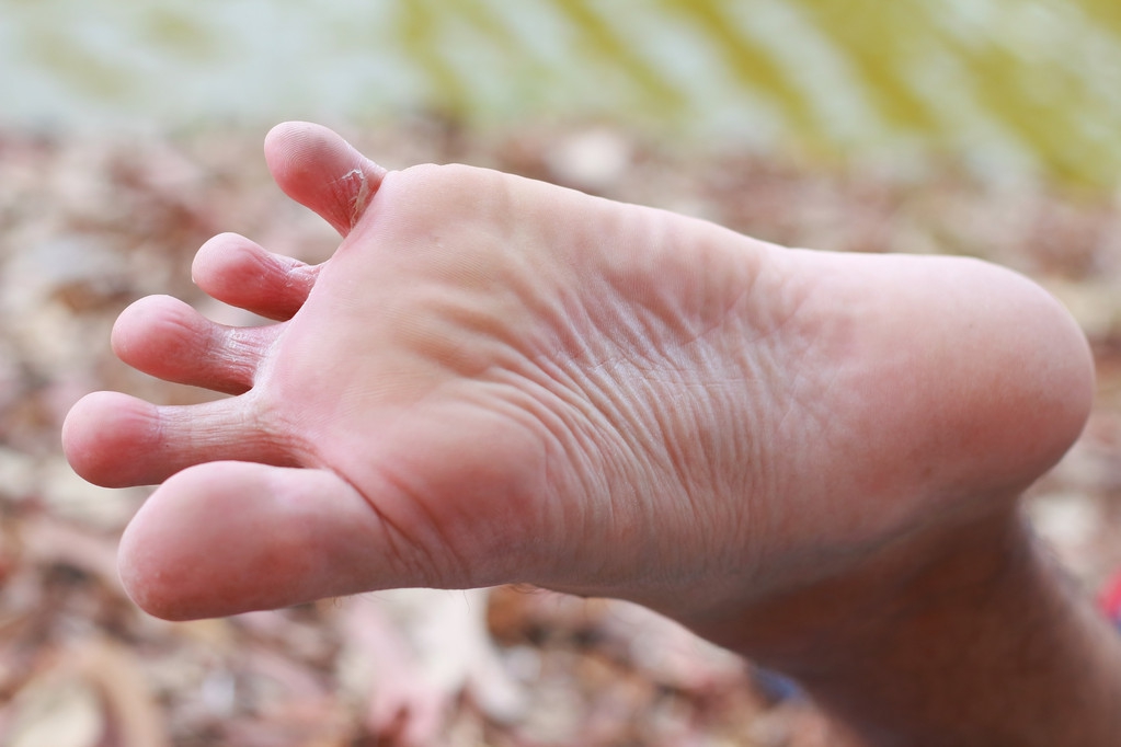 穿鞋子脚气臭怎么解决,日本人脱鞋脚臭解决方法