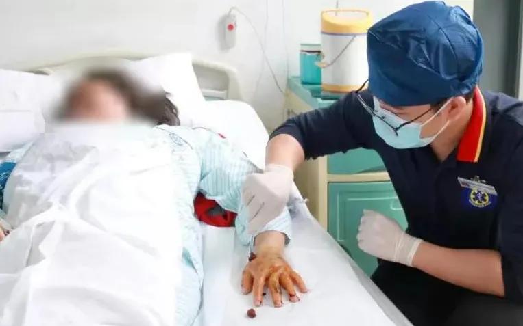 深圳毒蛇分布 (毒蛇高发地区)