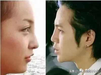 鼻子怎么修复好看呢,鼻型修复方法大全