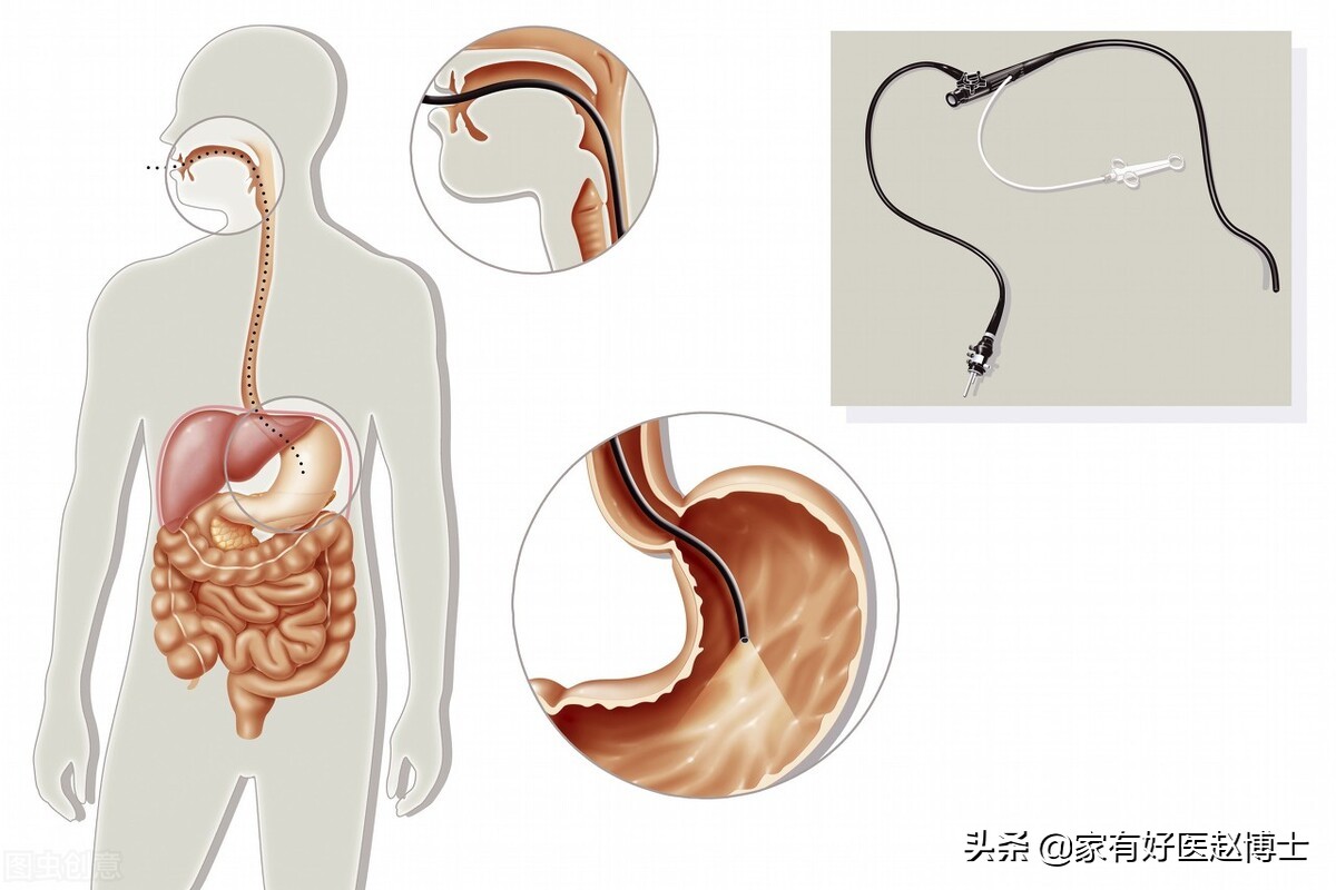 六大高发癌症早筛攻略,六大癌症有哪些