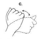 腕舟骨骨折康复训练视频,腕舟骨骨折打了石膏康复需要多久