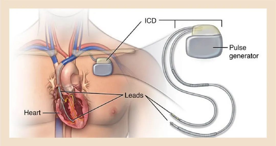 阜外医院主任医师心内科专家,阜外医院华伟医生做房颤怎么样