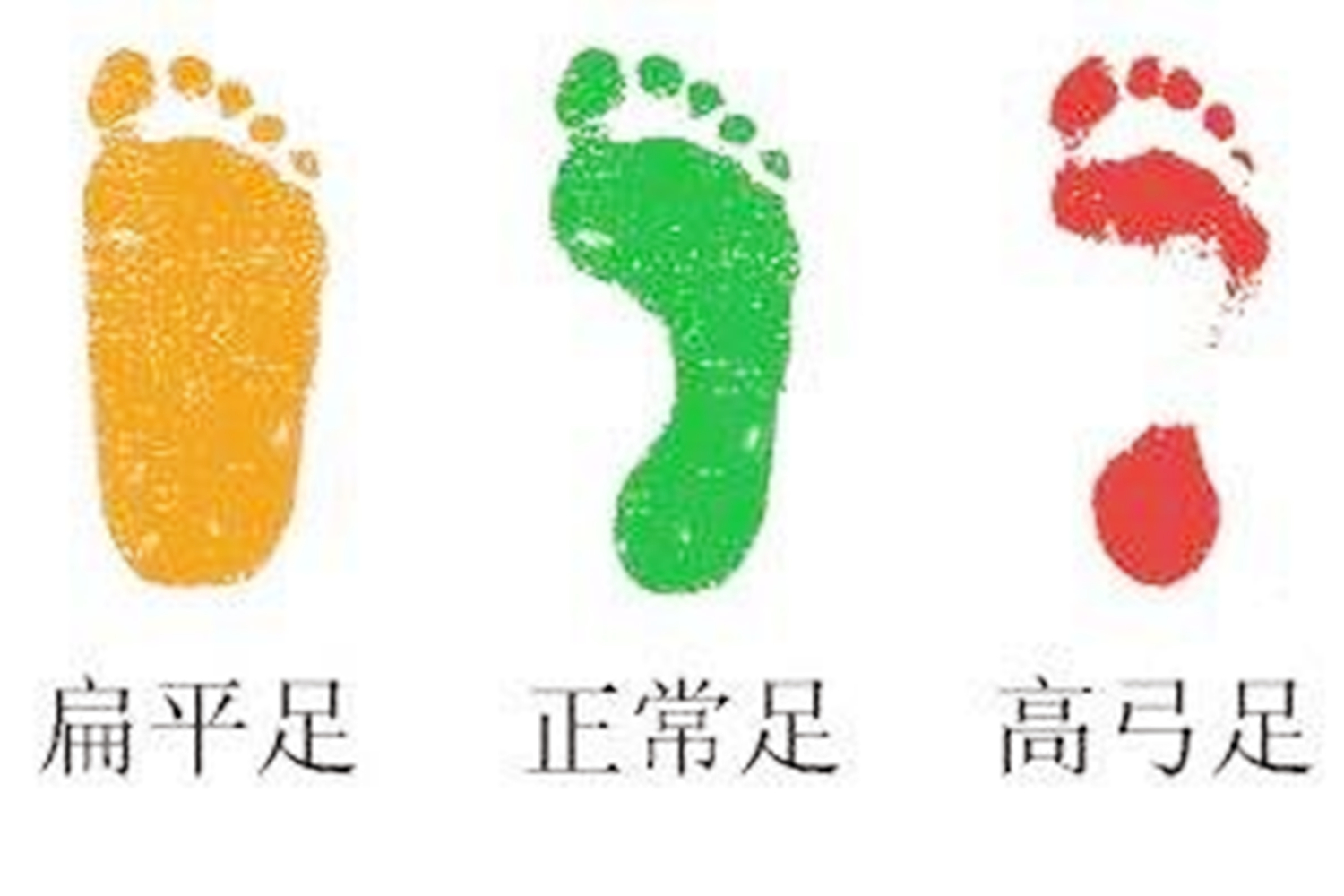 给孩子买鞋别只看颜值，穿得不对影响脚部发育不说，还有健康威胁