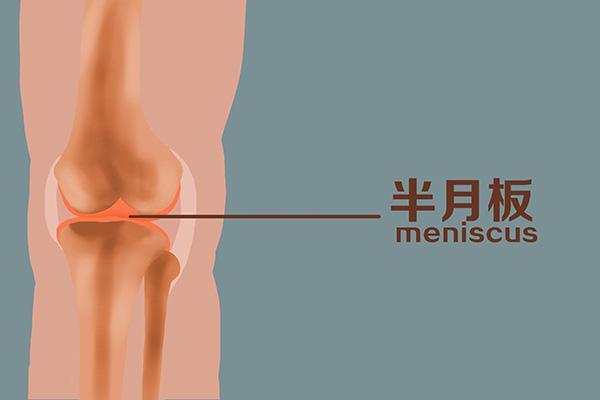 每次膝盖蹲下会咔咔的声音,蹲下起来膝盖咔咔响怎么解决