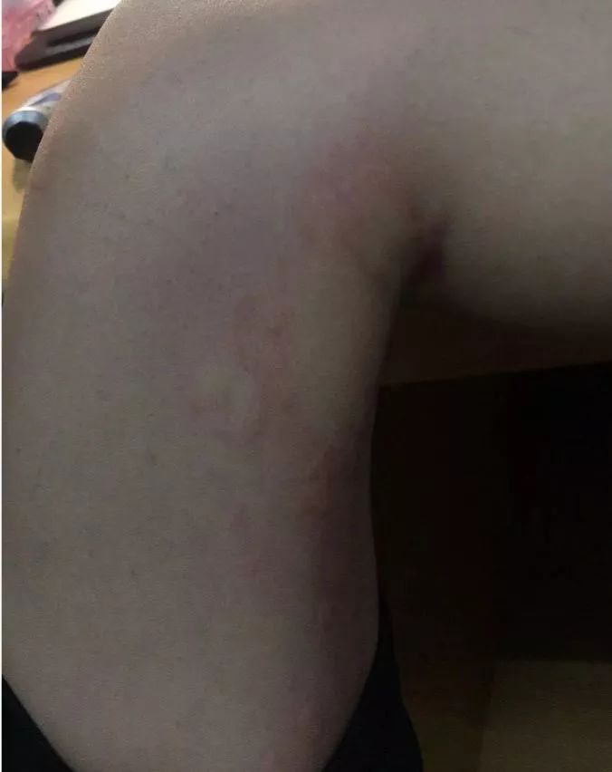 儿童春季常见疾病及治疗,当心这几类传染病近期高发