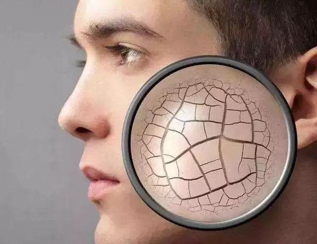 脸部皮肤突然变得粗糙干燥,皮肤为什么会变得干燥