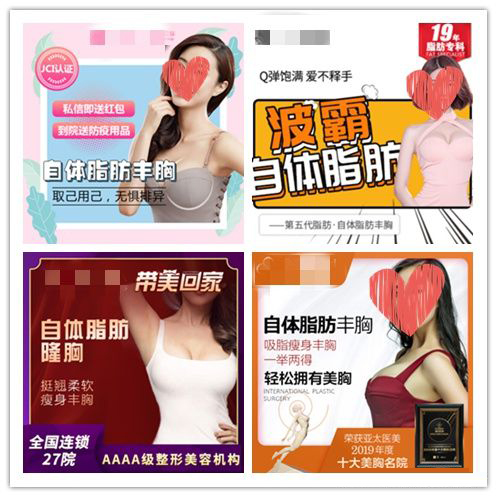 自体脂肪隆胸怎么和之前对比,假体隆胸和自体脂肪填充眼睛很肿