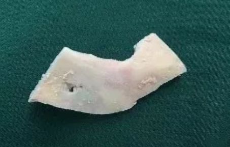 多大年龄出现牙痛,小小年纪就有牙痛怎么办