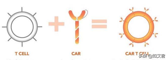 关于car-t疗法治疗艾滋病的研究,car-t治疗艾滋病在哪使用