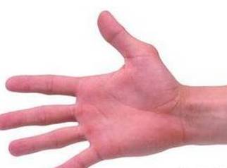 手掌什么颜色代表疾病及图片,手掌各个穴位的颜色反映什么疾病?