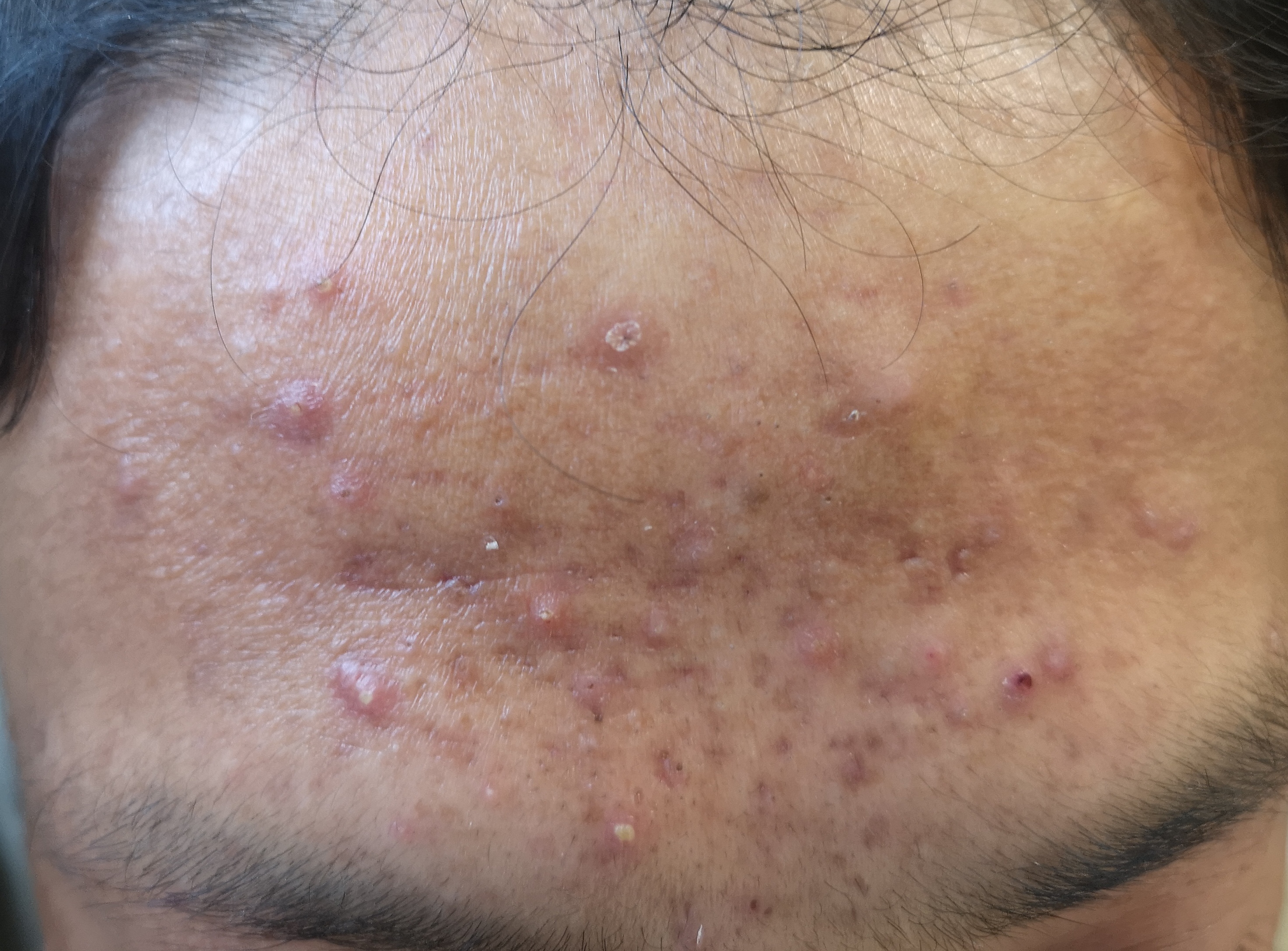 让你悄悄变美的4个小细节,让你偷偷变美的三种药膏