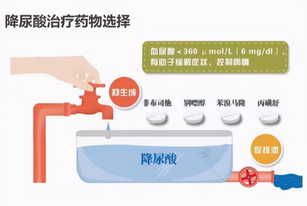 治痛风降尿酸的药分别有哪些,降尿酸治痛风吃什么药最安全有效