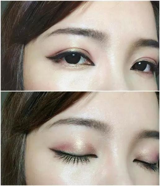 鼻头大怎么改善变小,鼻子不好看怎么办隆鼻