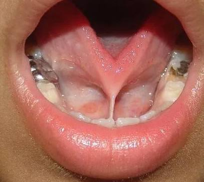 宝宝说话卷舌特别严重怎么纠正,宝宝说话不清楚舌头比较僵硬