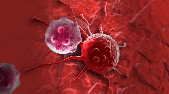 富于细胞性平滑肌瘤应注意什么,良性平滑肌瘤能治好吗