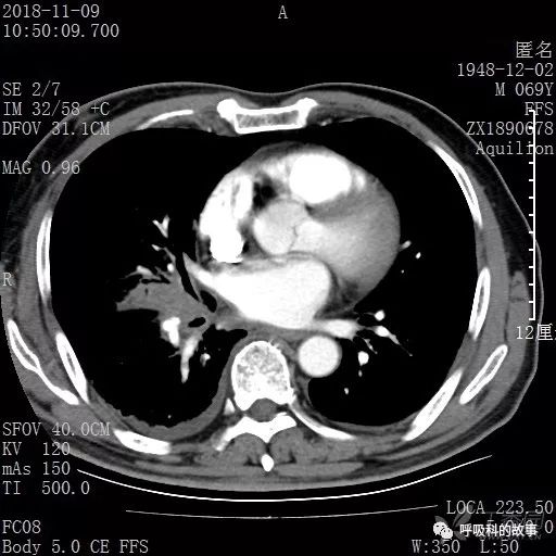 怎么应用统计学做调查,统计学方法可以解决的主要问题