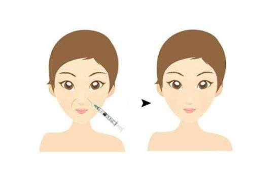 有法令纹眼袋深显老怎么办,有法令纹怎么打腮红不显老