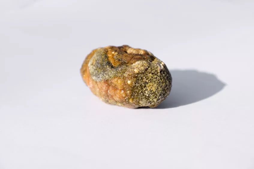 体检发现胆结石，胆囊到底切不切？