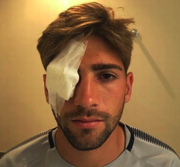 博卡大巴车事件,南美足球比赛大规模冲突球迷暴怒