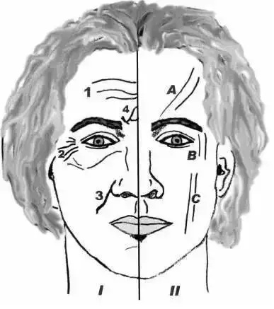 有眼纹了怎么办,30岁有眼袋眼纹很显老的感觉