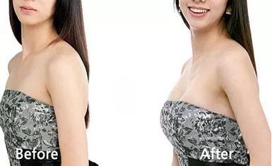 关于丰胸的收获和感悟,女生为了丰胸增肥可以么