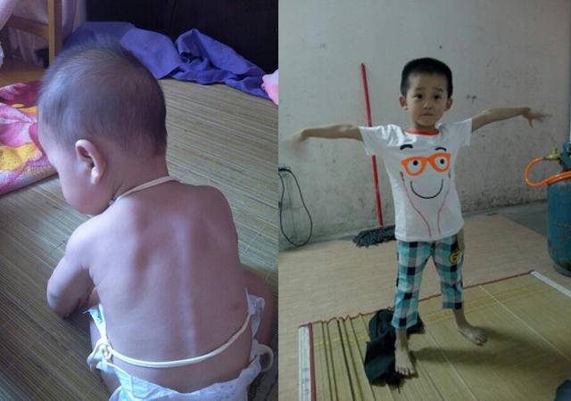 吃不胖的孩子吃什么才长肉,小孩吃多不长肉怎么调理