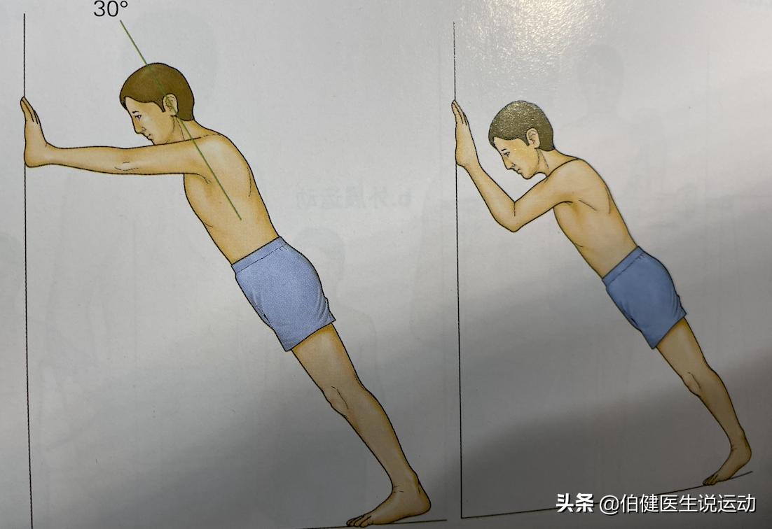 肩袖三级撕裂保守治疗效果,肩袖撕裂保守治疗的方法