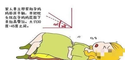 15周胎膜早破下次怀孕应注意什么,胎膜早破的科普视频