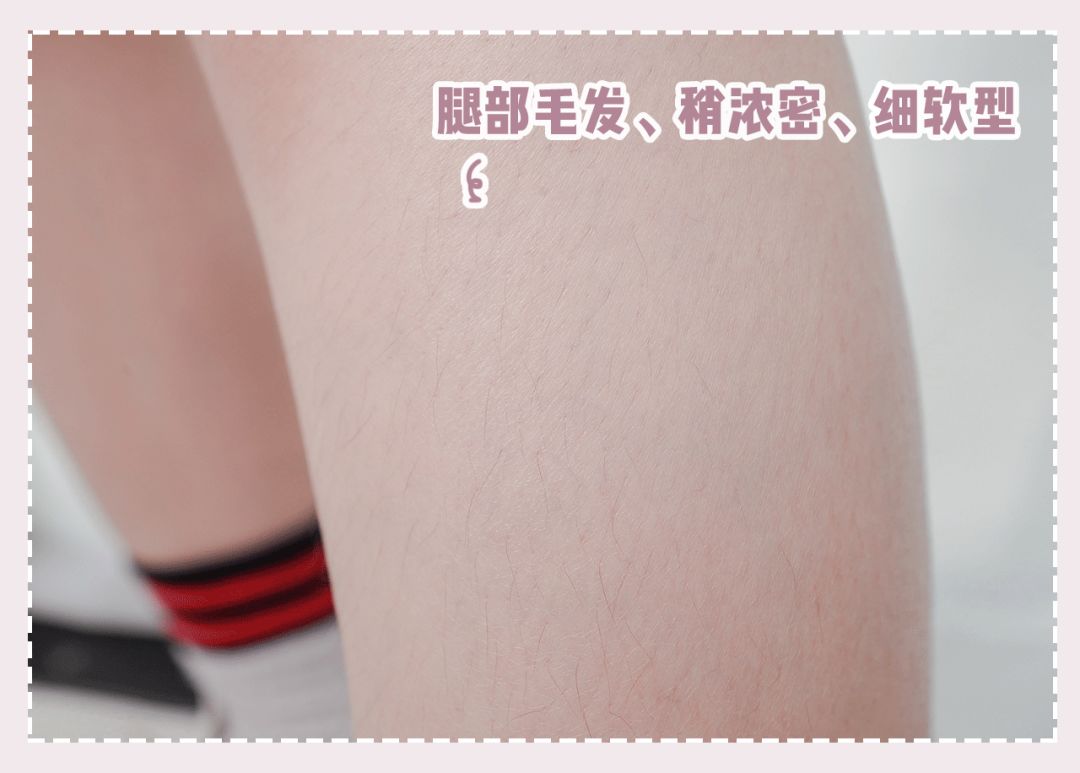 体毛脱毛的效果怎么样,天生体毛旺盛的人正常吗