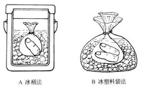 专家提醒：皮肤撕脱？记住！千万不要扔，对回植皮肤有重要作用