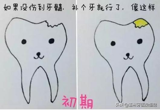 浅蛀牙补牙齿一般多少钱,牙齿蛀牙补一颗要多少钱