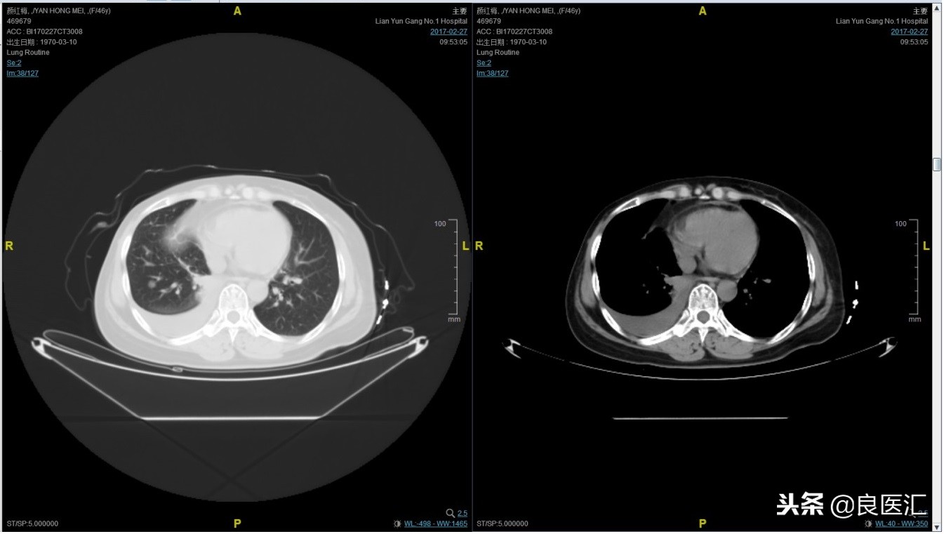 美图秀秀成功案例,美图秀秀实战案例