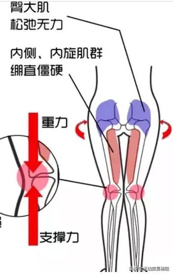 脚踝扭伤长期不好,脚踝扭伤后休息20天怎么康复