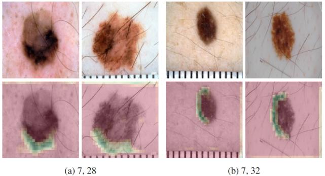 浅谈医学影像技术,医学图像分析深度学习模型