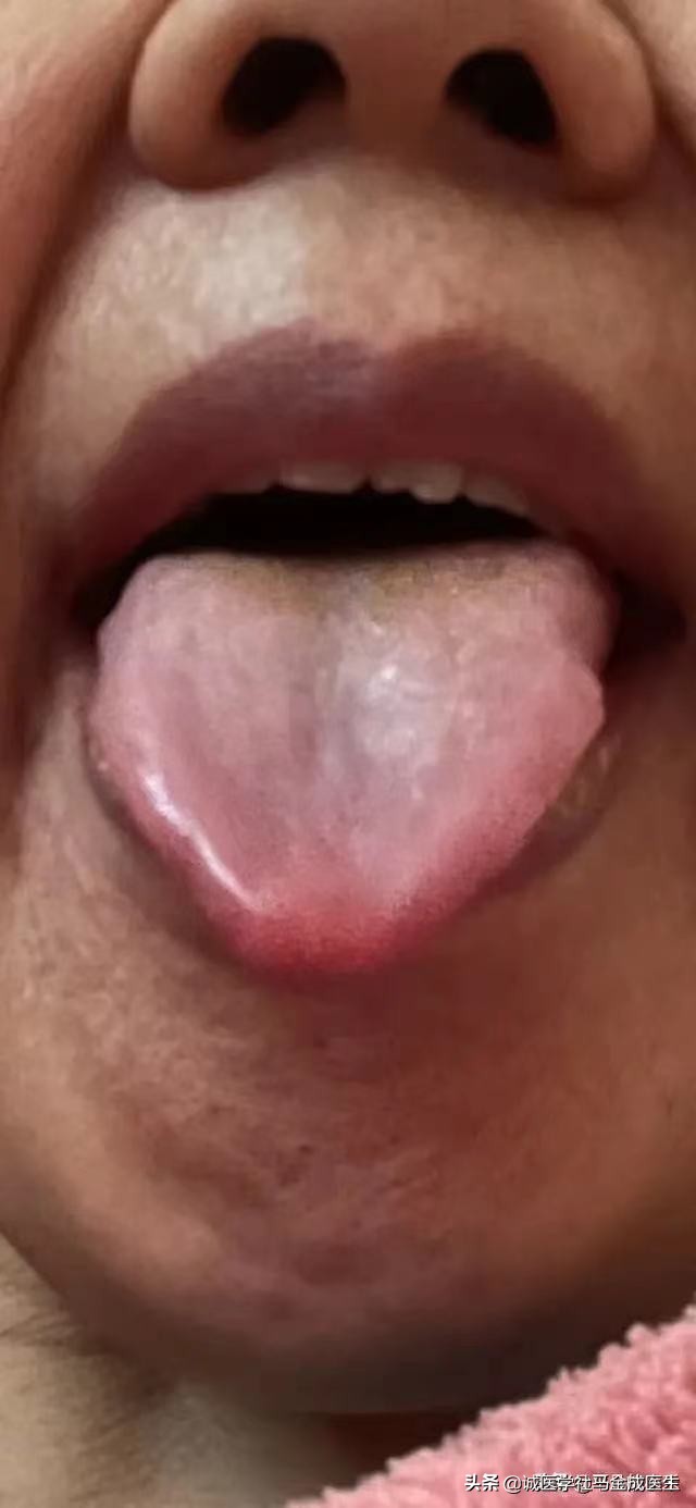 肝血不足月经量少吃什么中成药,痛经吃哪种中成药见效快