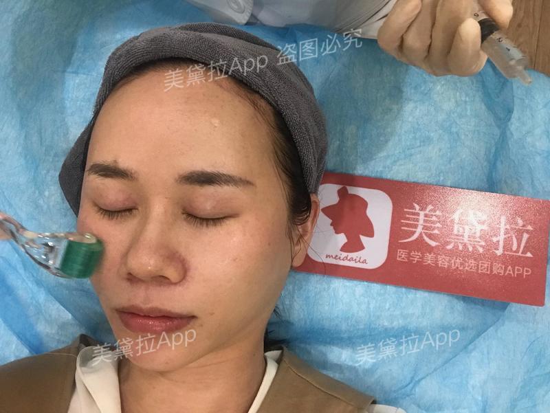 类人胶原蛋白能收缩毛孔么,胶原蛋白抗皱原液真实测评