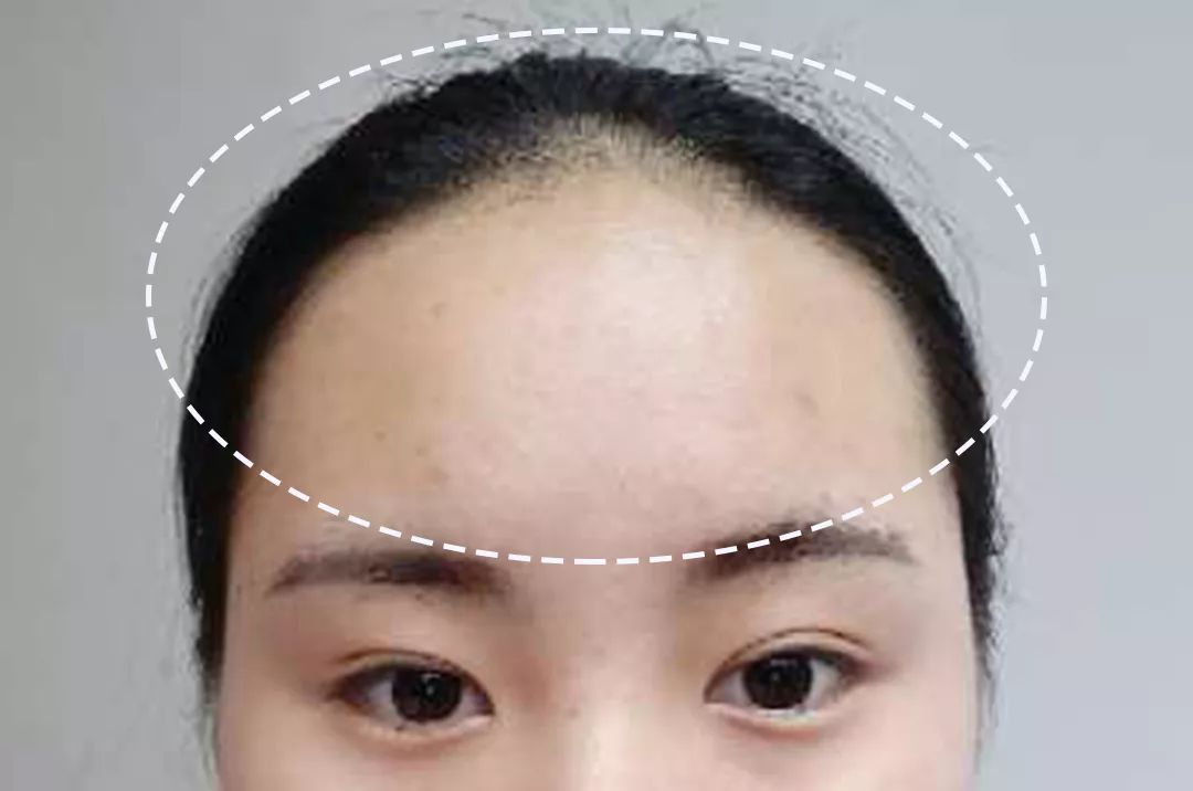 求改善痘痘真实办法,想改变脸上痘痘