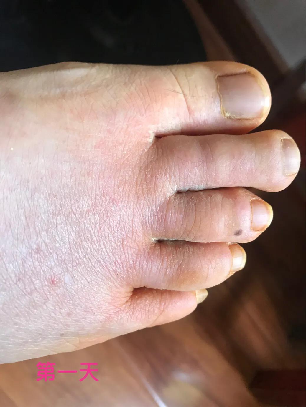 自己用中药熬的面膜靠谱吗,自己用中药做的面膜好吗