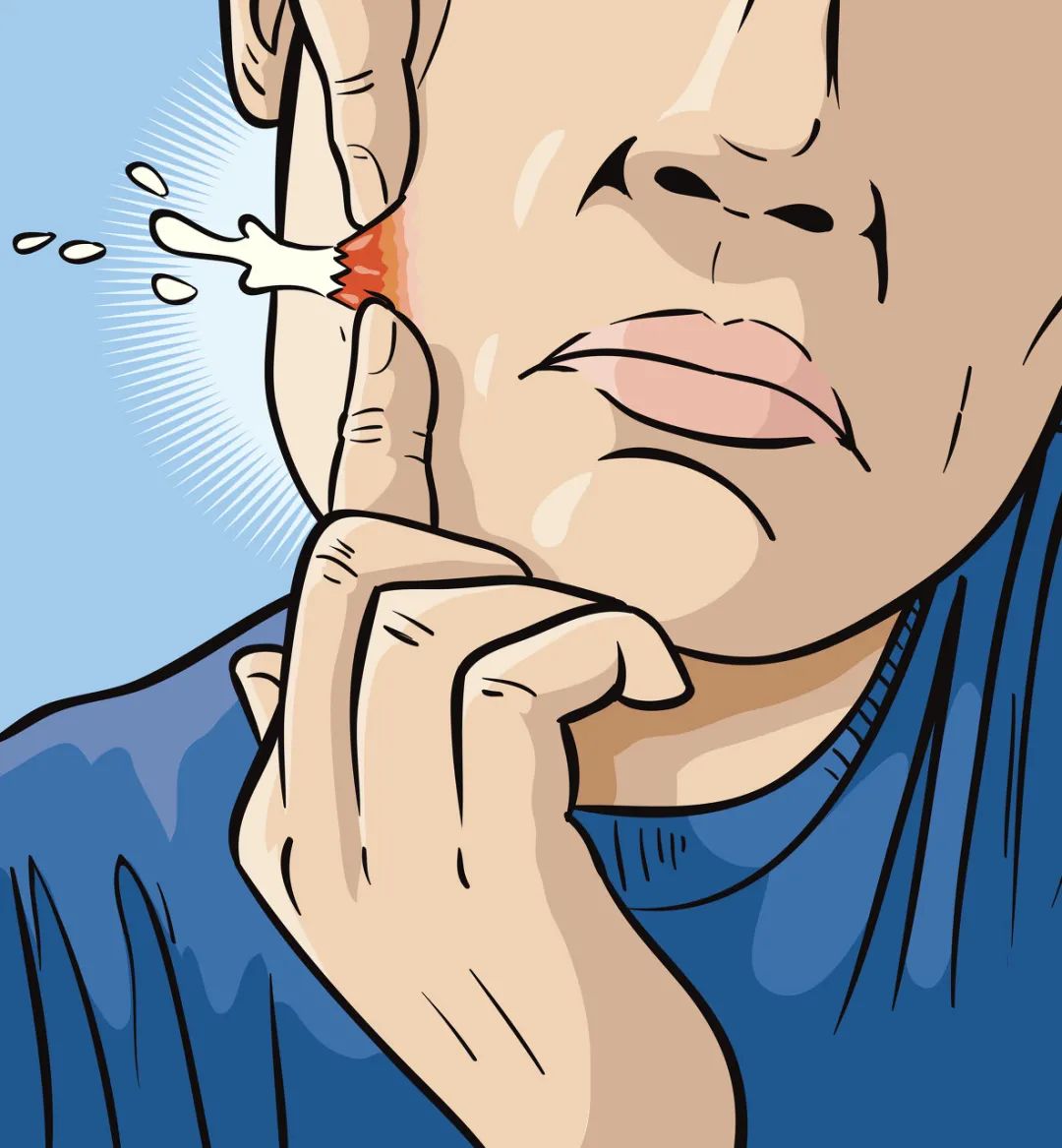 脸旁边及以下长痘痘怎么办,除脸以外的地方长了痘痘怎么办