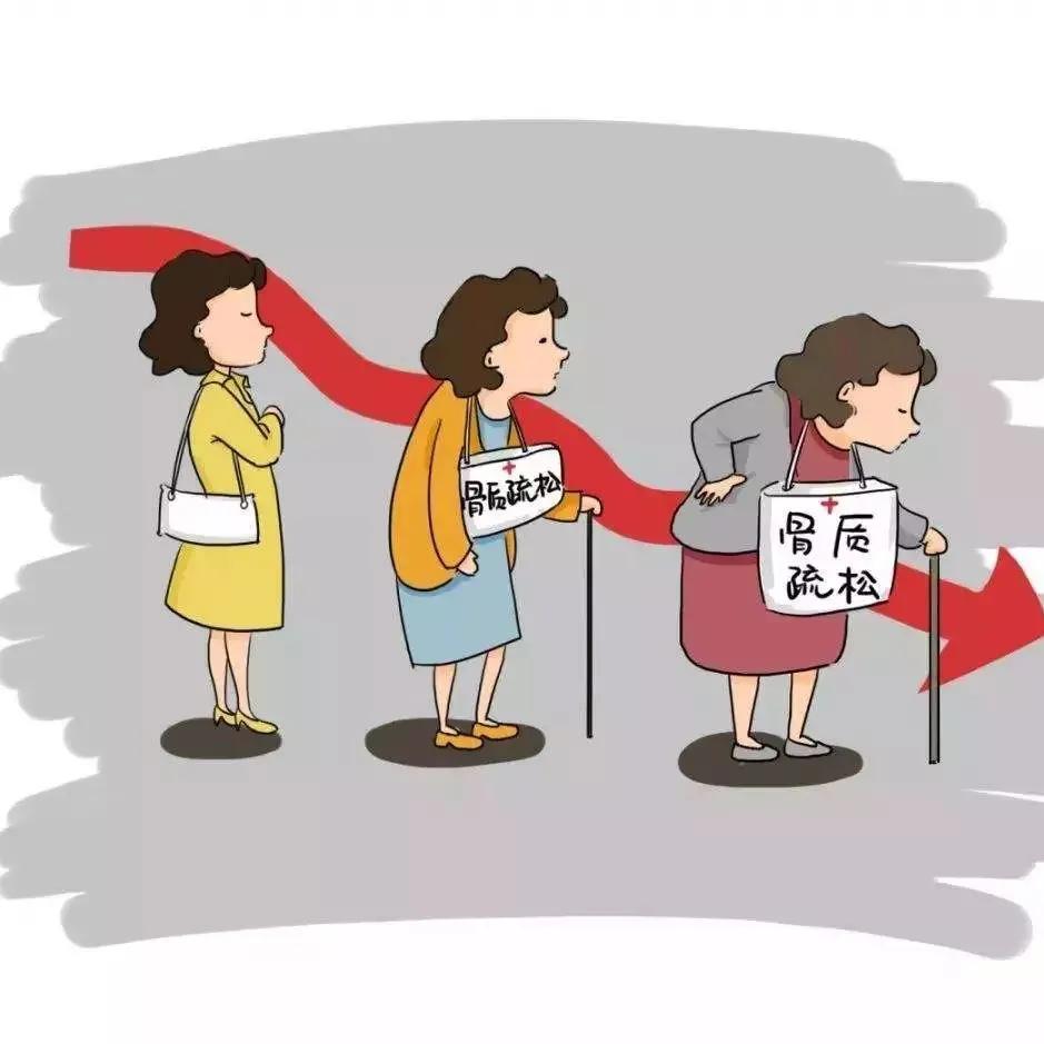 老年人骨质疏松需要什么检查,60岁严重骨质疏松能治好吗