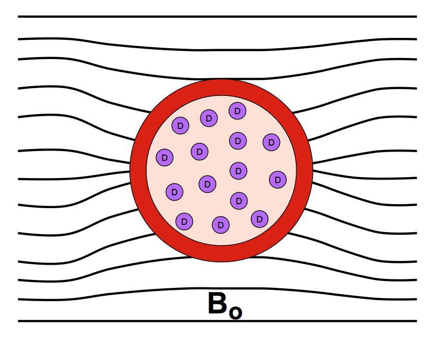 脑功能成像和血管成像,核磁共振脑成像mra是查什么的