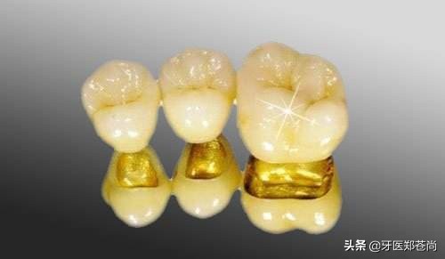 爱尔兰烤瓷牙好吗,烤瓷牙到底好不好用