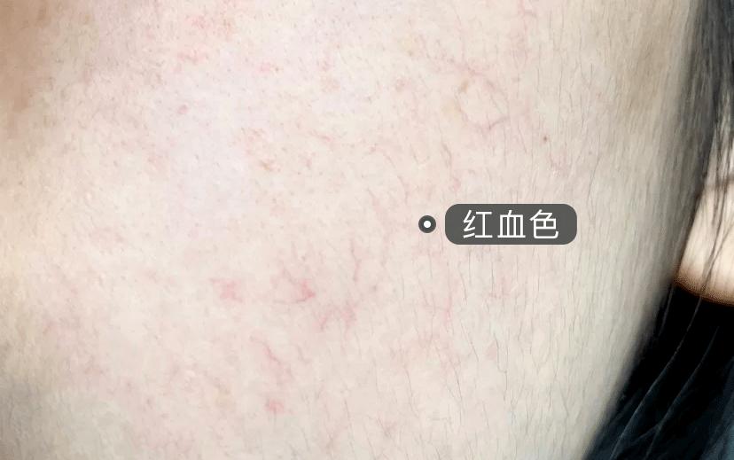 老国货祛痘真的有用吗,从明朝开始的国货