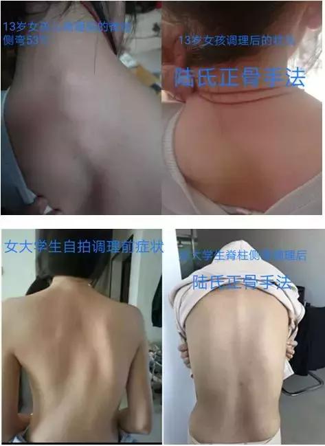 中国排名第一的正骨哪里最有名,陆氏正骨