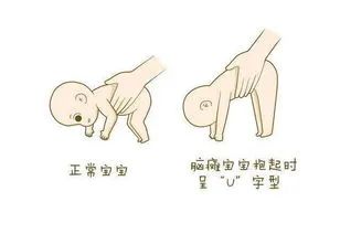 南阳有免费脑瘫康复的医院吗,南阳中医治脑瘫