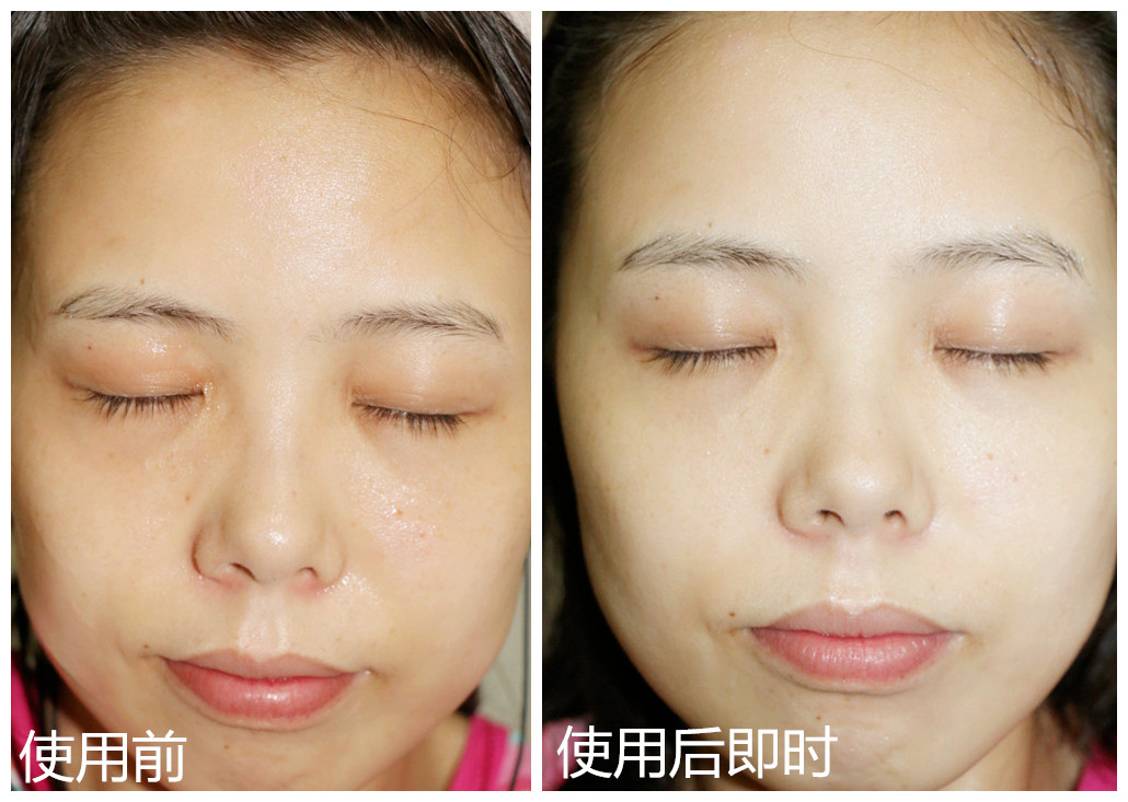 经常敷面膜有什么改善,经常敷面膜皮肤看起来还是很差