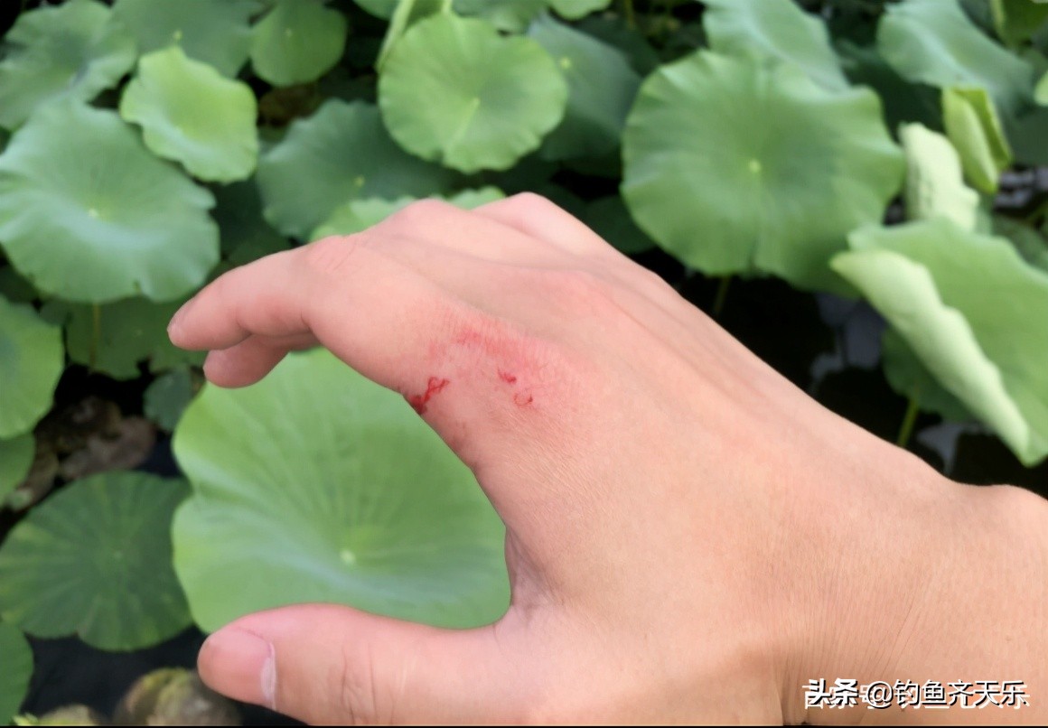 钓到大鱼被鱼咬到隐身部位,男子钓鱼被蛇咬伤